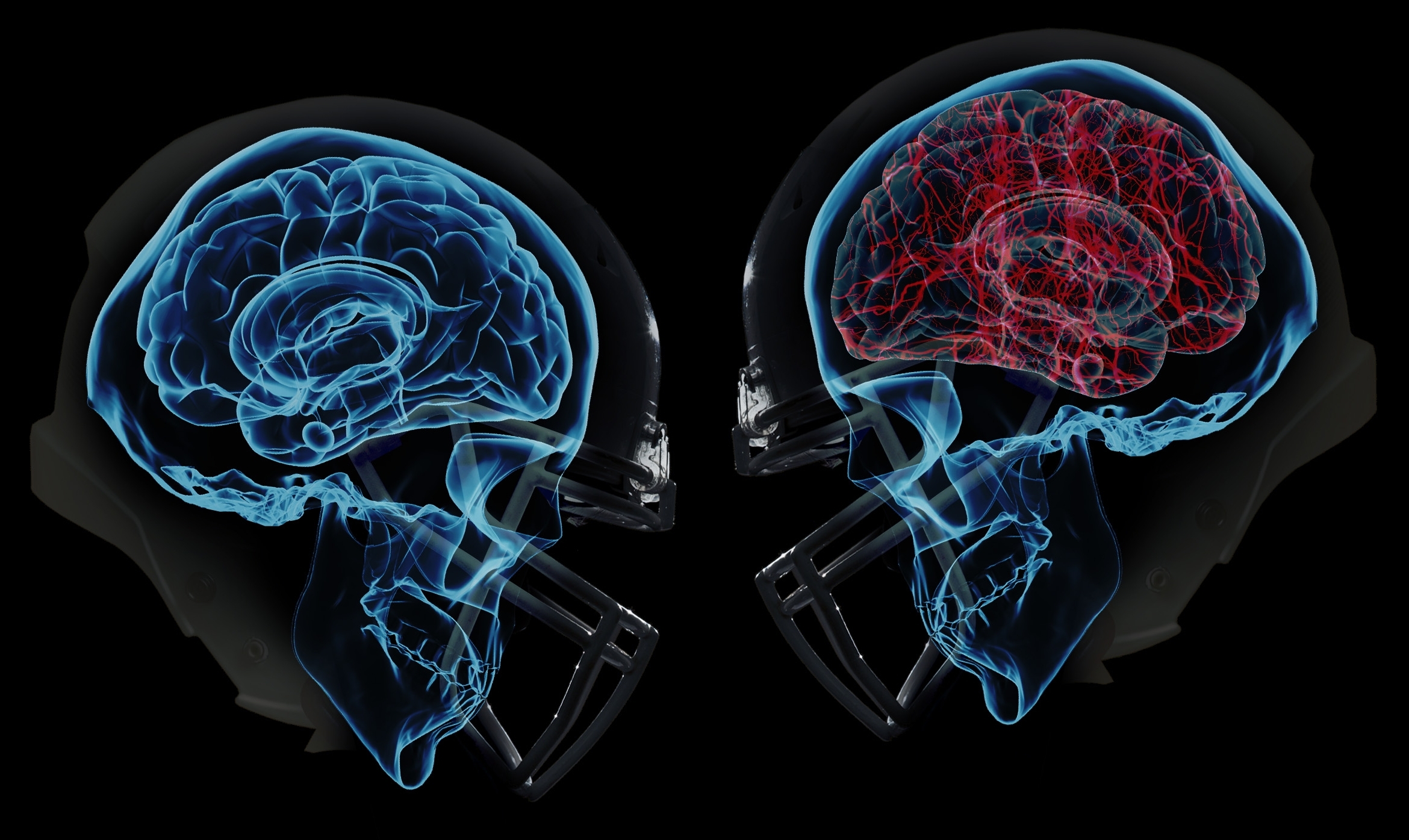 Images of Concussion | 2340x1395