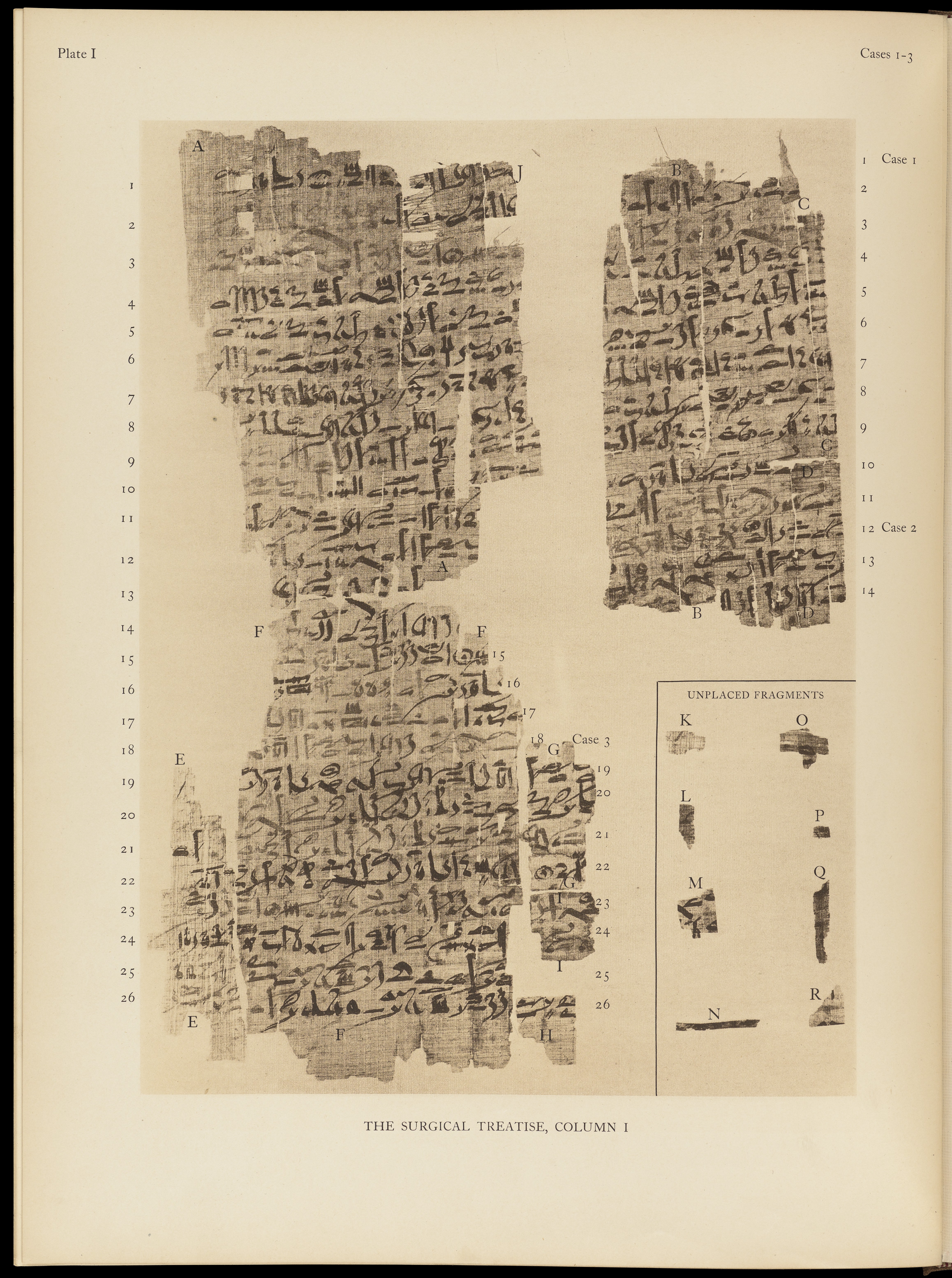 Edwin Smith Papyrus Pics, Man Made Collection