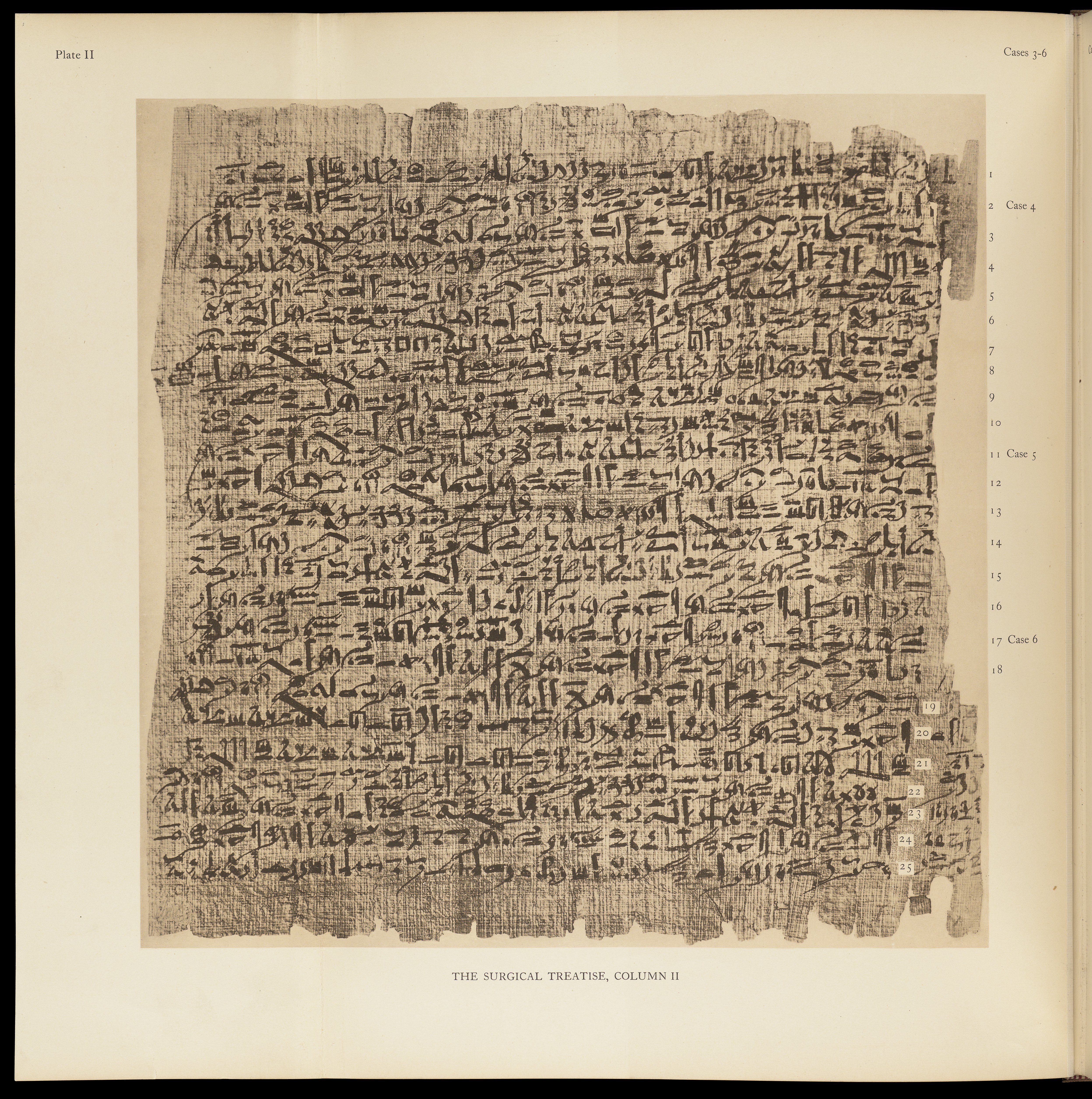 Edwin Smith Papyrus #10