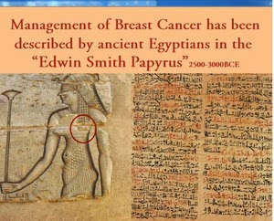 Edwin Smith Papyrus #13