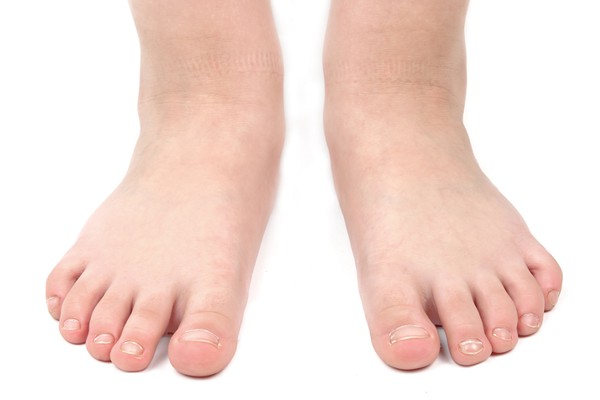 Images of Feet | 600x400