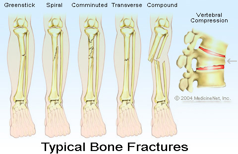 Images of Fracture | 480x310