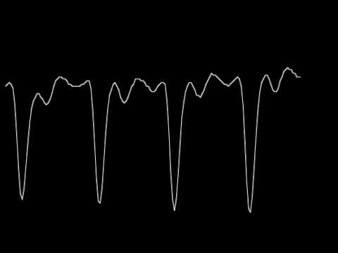 Heartbeat Wave #12