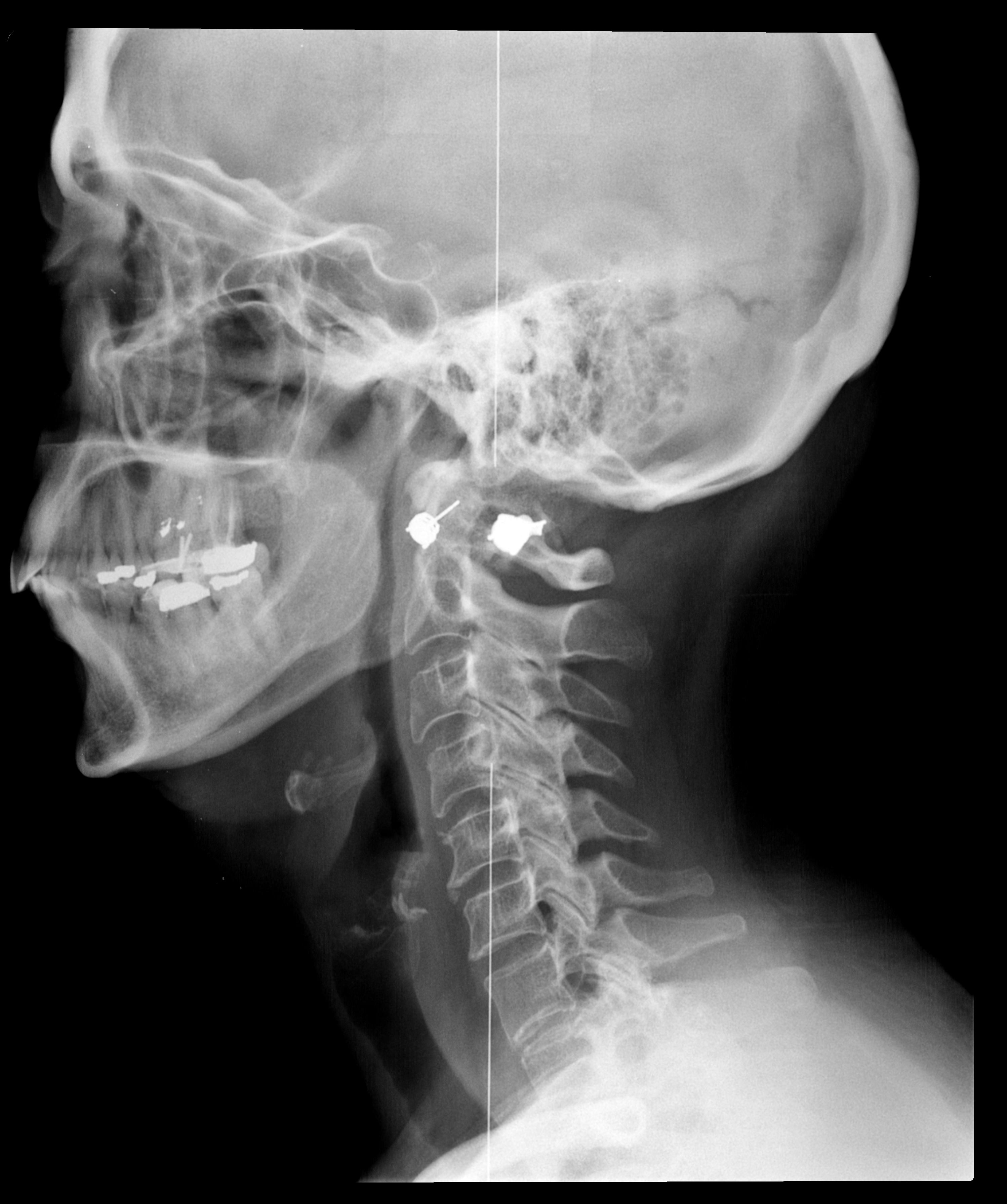 Снимок. Рентгеновский снимок головы.