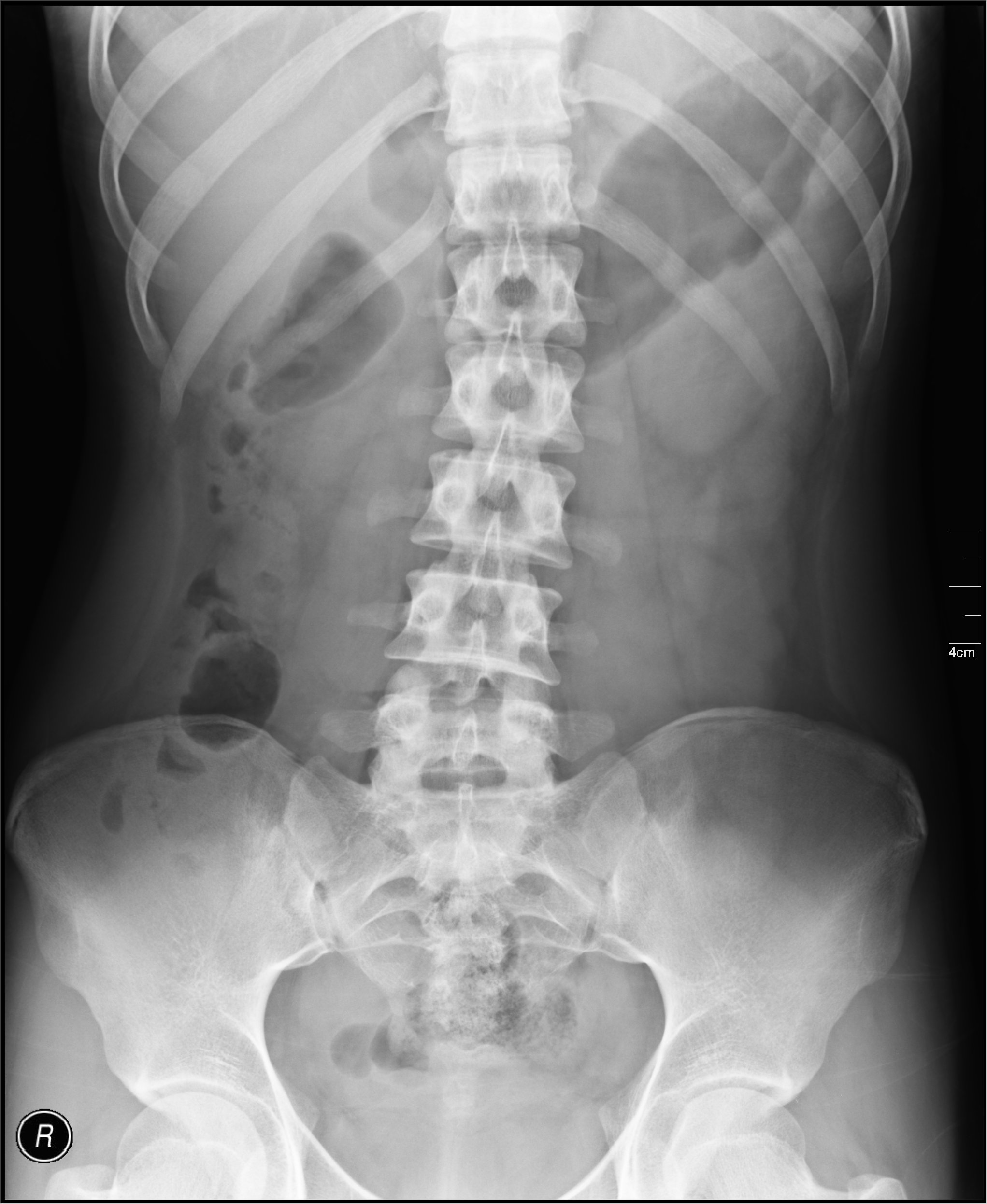 X-ray #15
